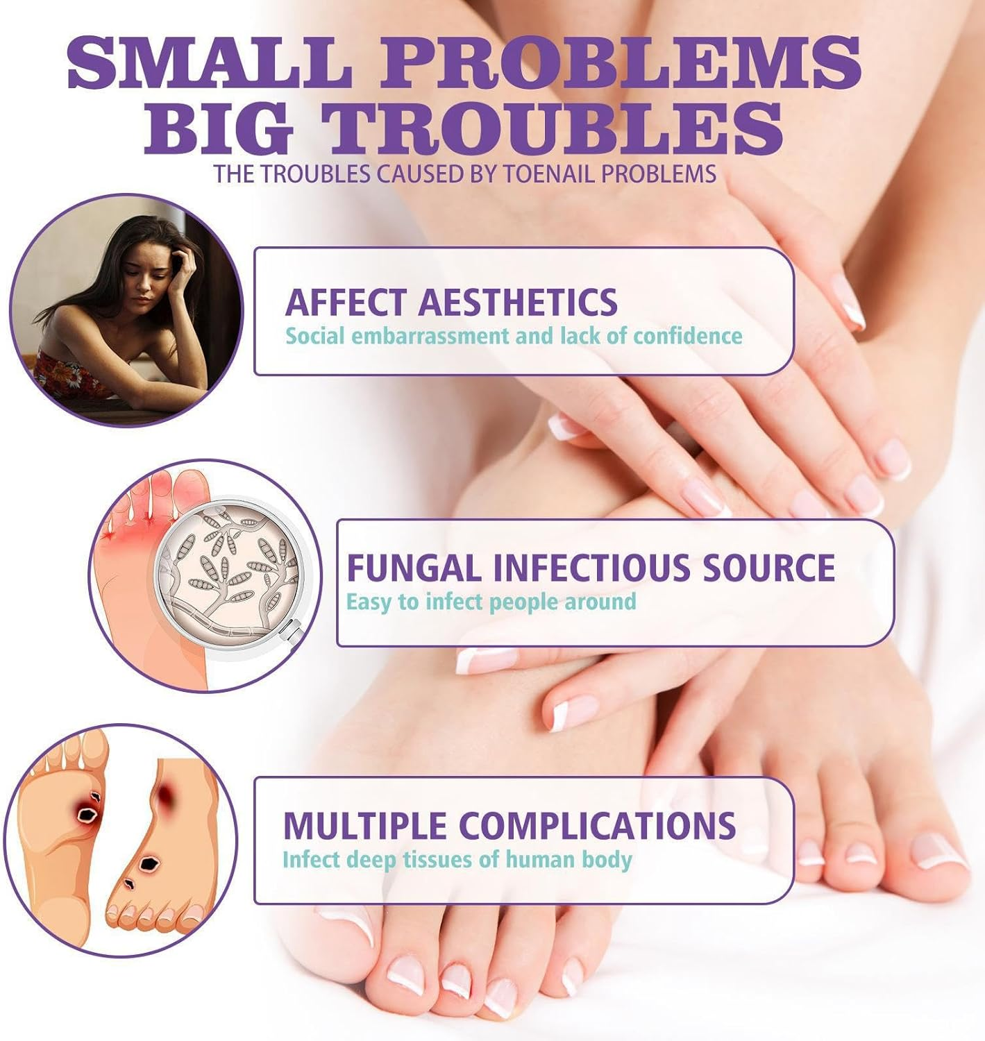 Extra Strong Nail Fungus Treatment Spray - 100ml