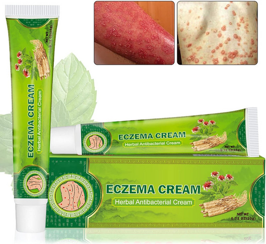 Eczema Cream Herbal Antibacterial Ointment 20g