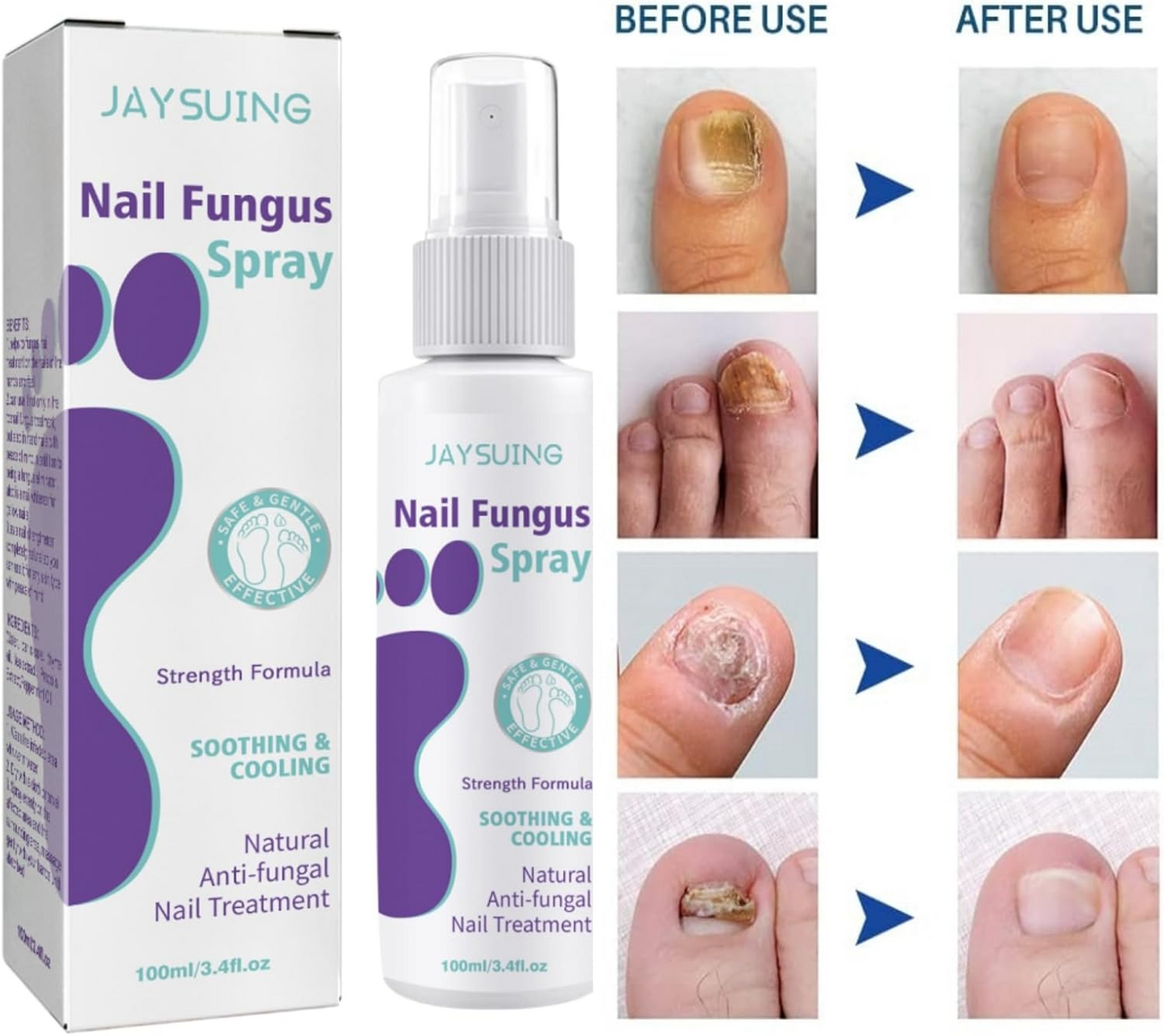 Extra Strong Nail Fungus Treatment Spray - 100ml