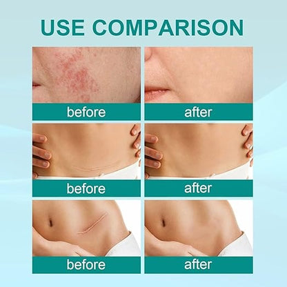 South Moon  Scar Spray