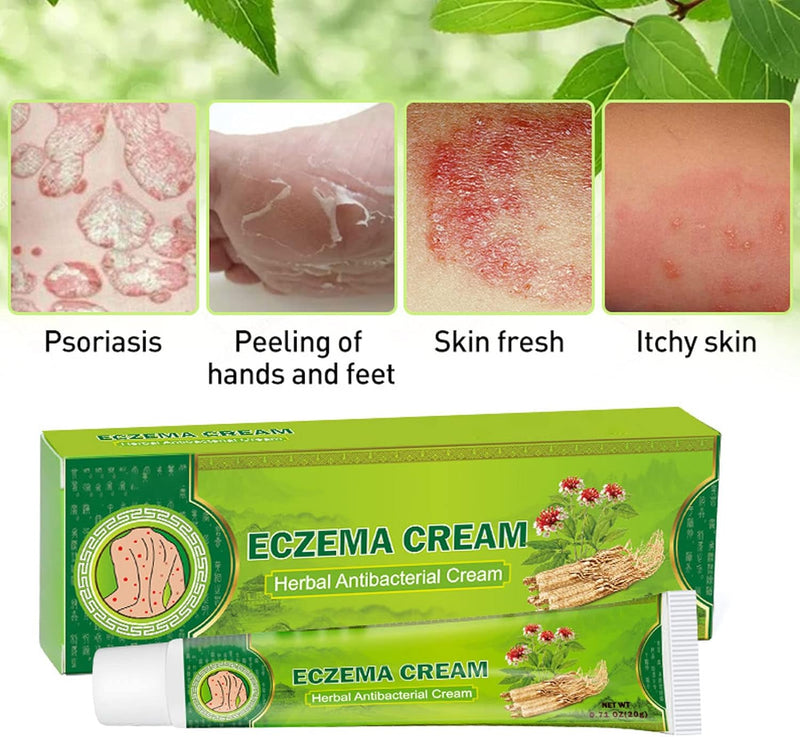 Eczema Cream Herbal Antibacterial Ointment 20g