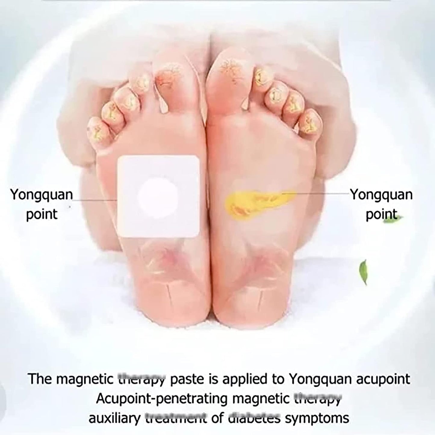 Huatangxiao Acupoint Pressure Stimulation Stickers