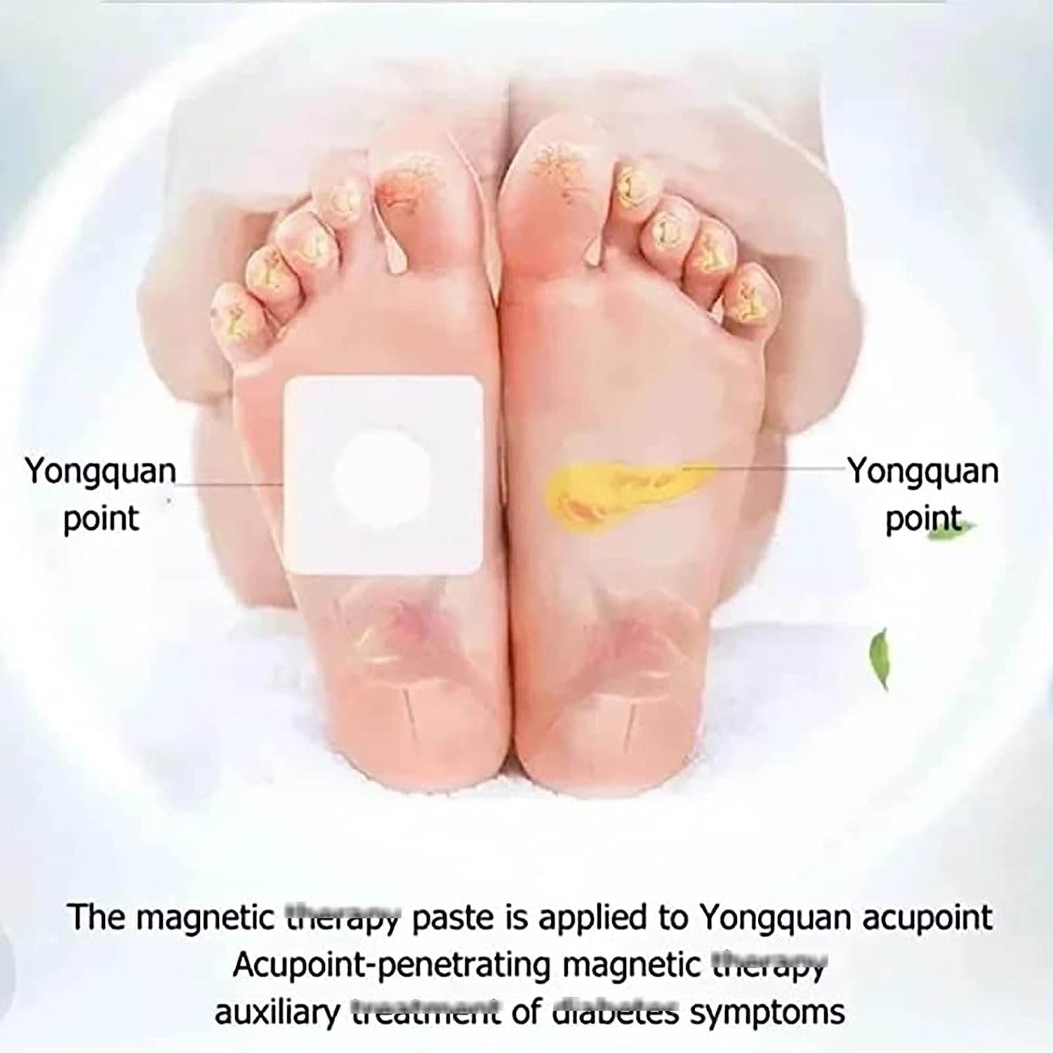 Huatangxiao Acupoint Pressure Stimulation Stickers