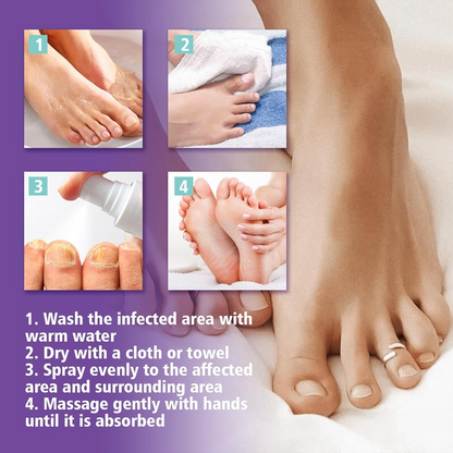 Extra Strong Nail Fungus Treatment Spray - 100ml