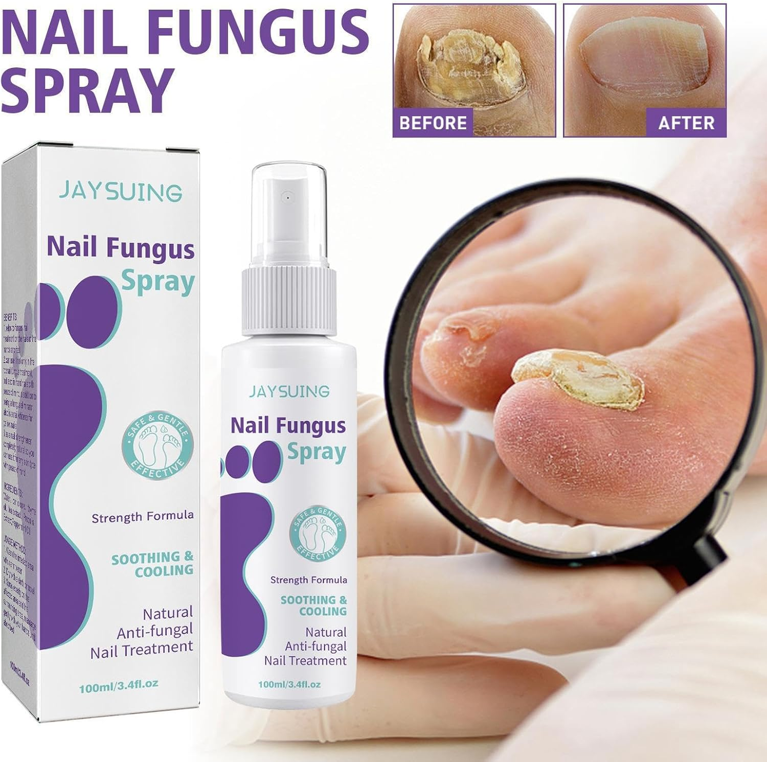 Extra Strong Nail Fungus Treatment Spray - 100ml
