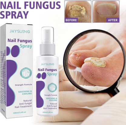 Extra Strong Nail Fungus Treatment Spray - 100ml