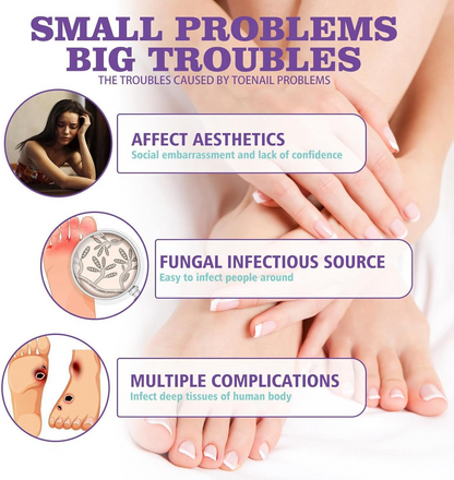 Extra Strong Nail Fungus Treatment Spray - 100ml