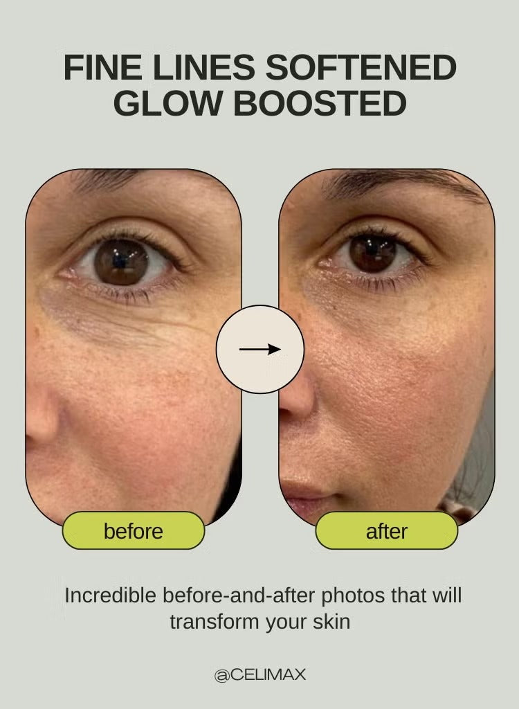 Retinal Shot Tightening Booster